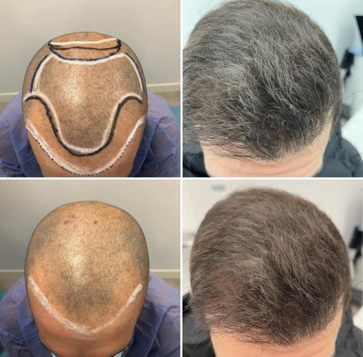 WhatsApp Image 2024-08-27 at 12.05.05 (3)